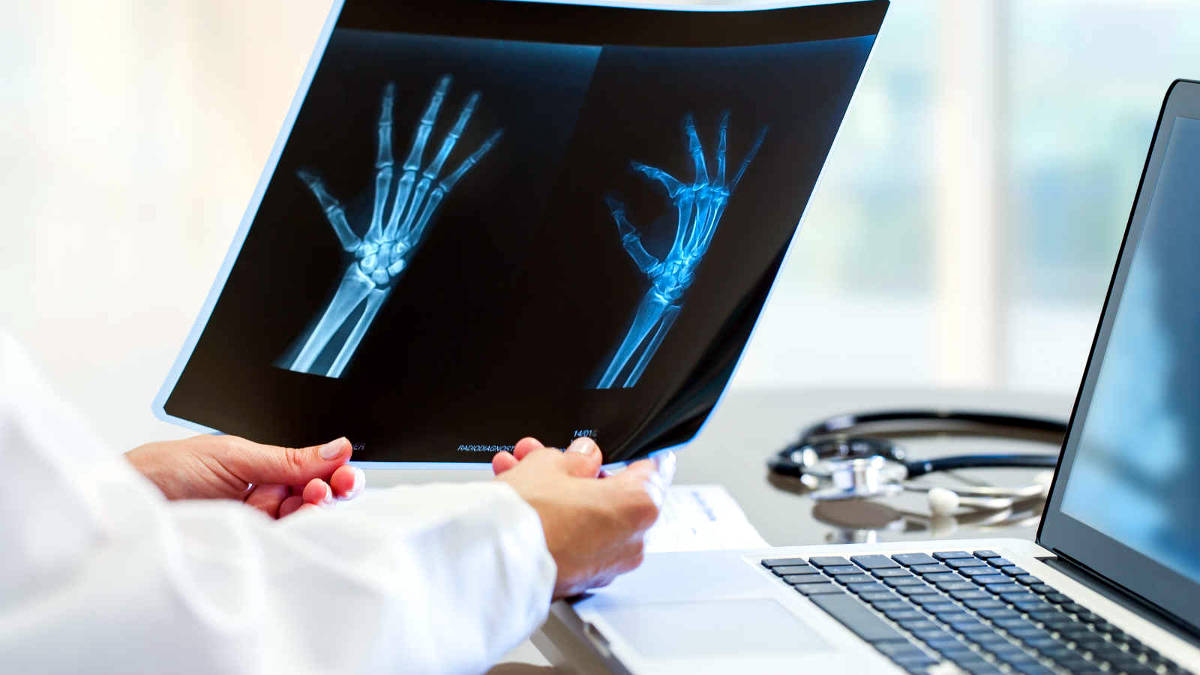 Experienced Hand Injuries Attorney in San Diego